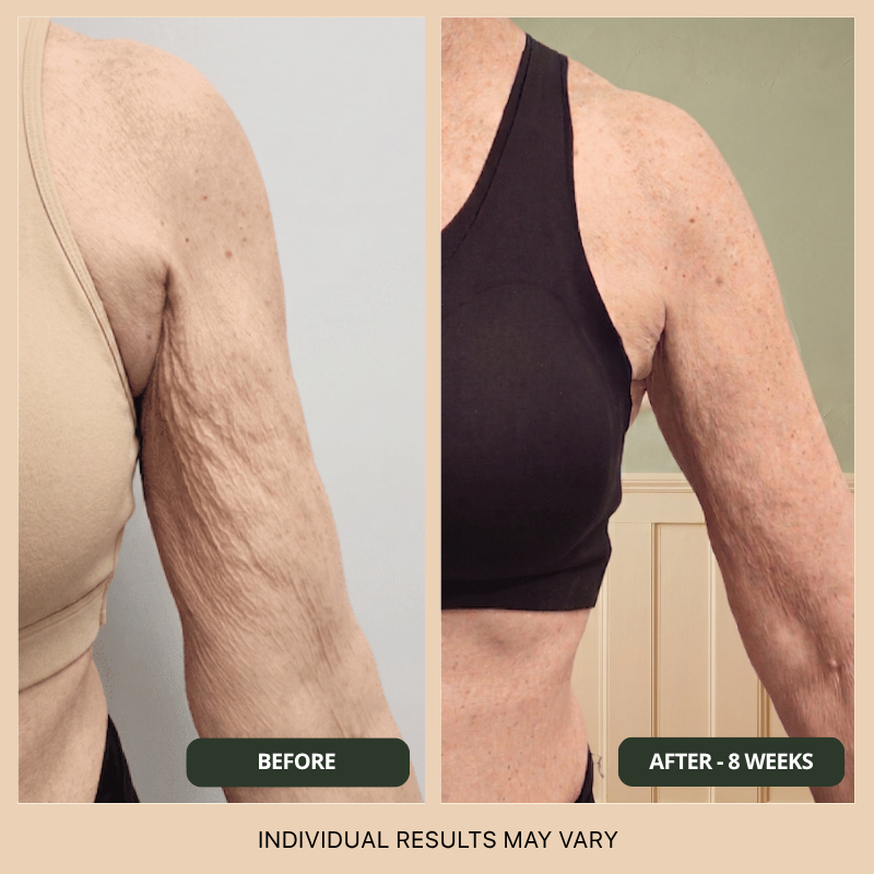 Firmora™ Multi-Peptide & Anti-Cellulite Body Oil