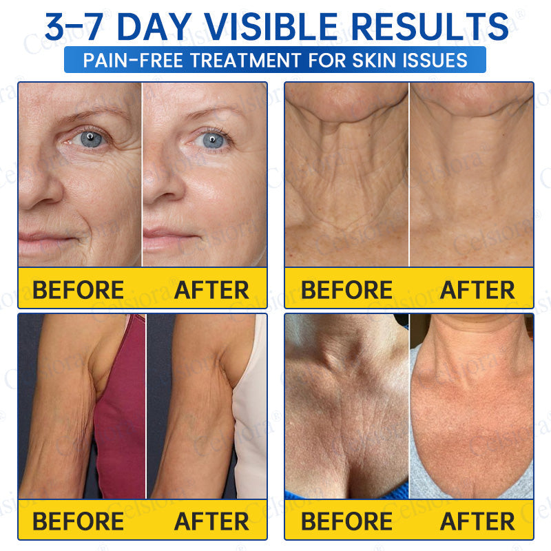 Celsiora® Firming Cream
