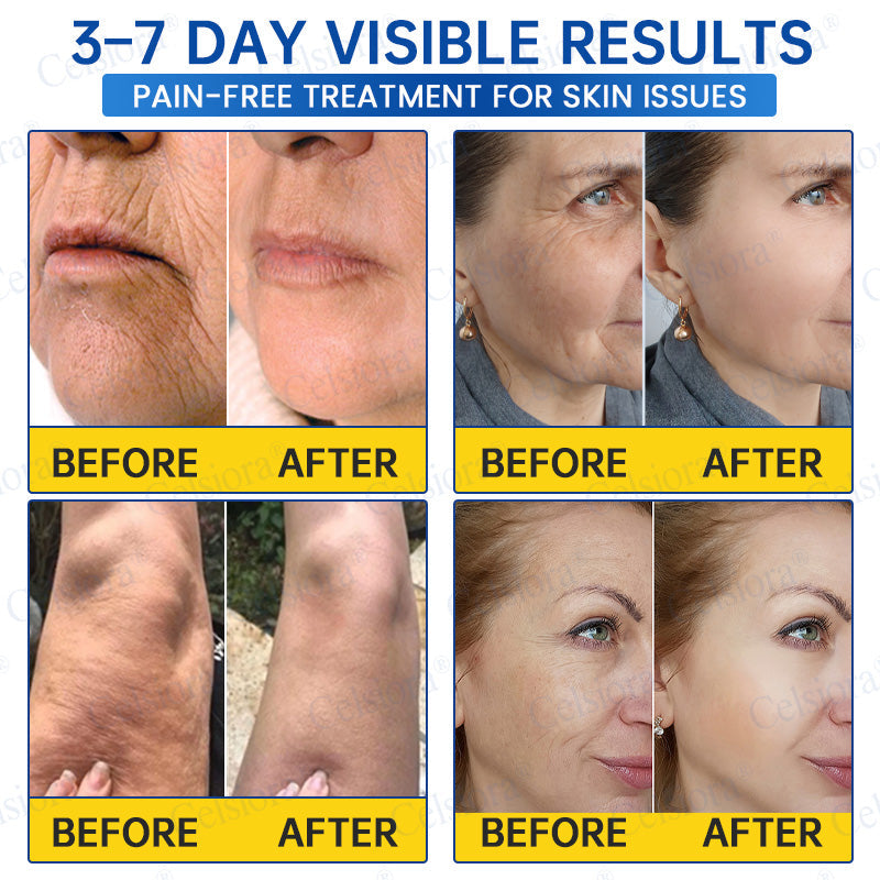 Celsiora® Firming Cream