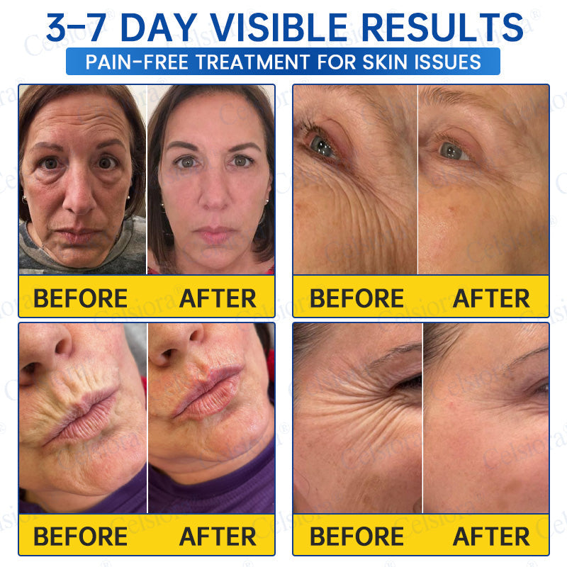 Celsiora® Firming Cream