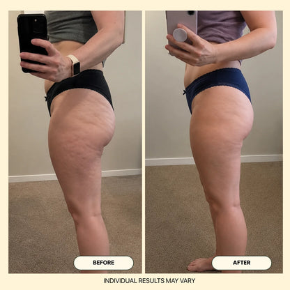 Firmora™ Multi-Peptide & Anti-Cellulite Body Oil
