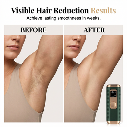 Ice Cooling IPL Hair Remover